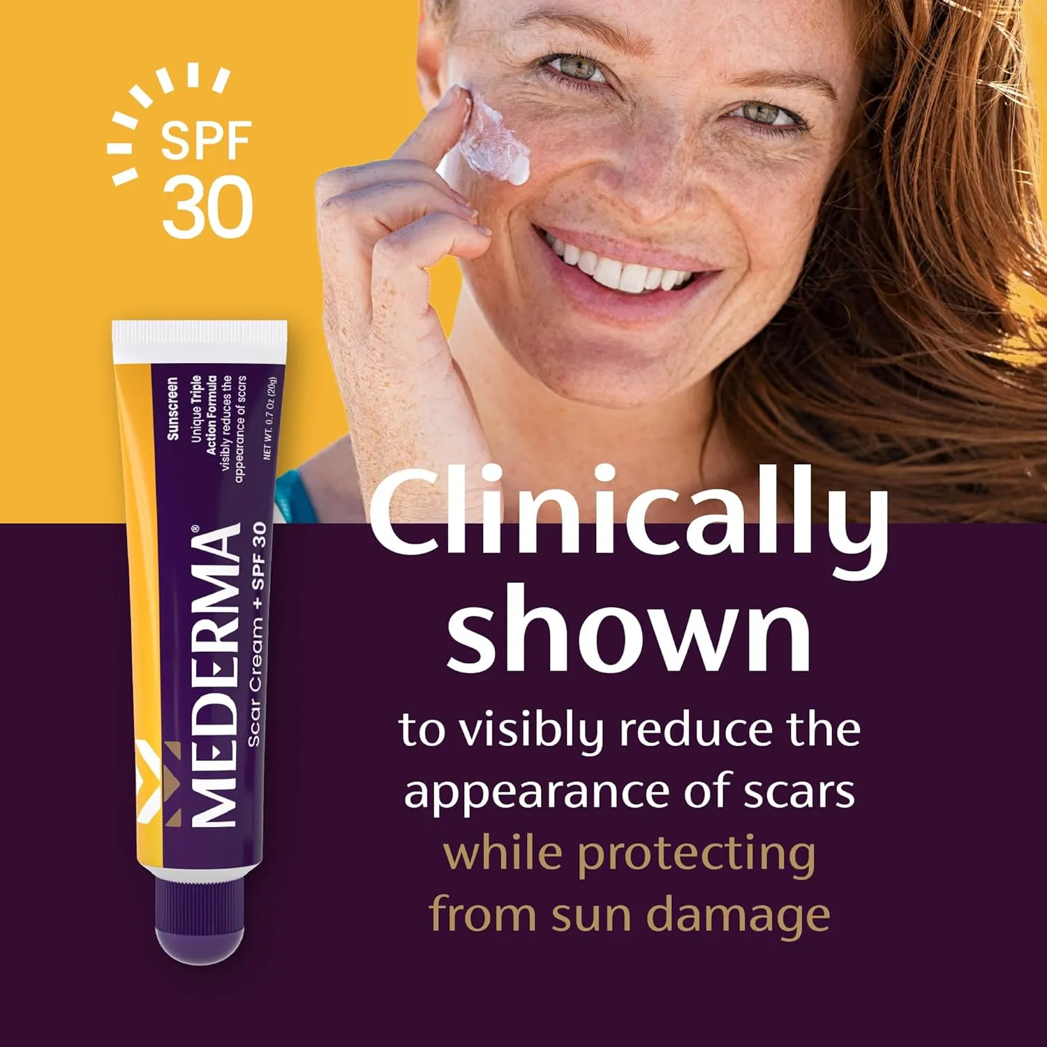 Mederma Scar Cream Plus SPF 30, Sunscreen, Protects from Sun Damage, Reduces the Appearance of Scars, 40 Grams, (2 x 20g)